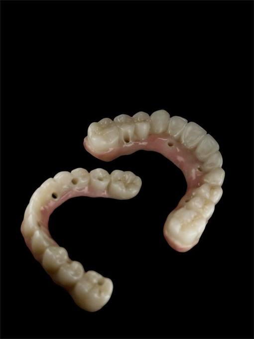Titanium Zirconia Prosthesis BOC Lab